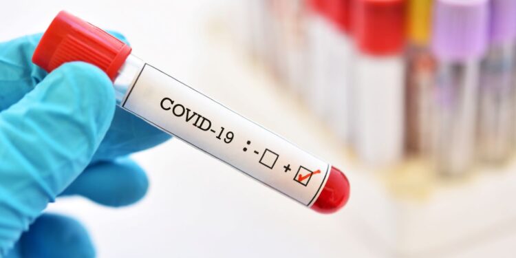 Singapore Sees 28% Spike in COVID-19 Cases in Early May